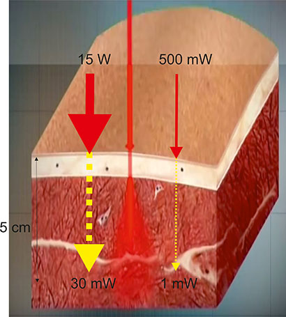 Penetration laser cl. 4 versus cl. 3B Laser cll. 4 penetration